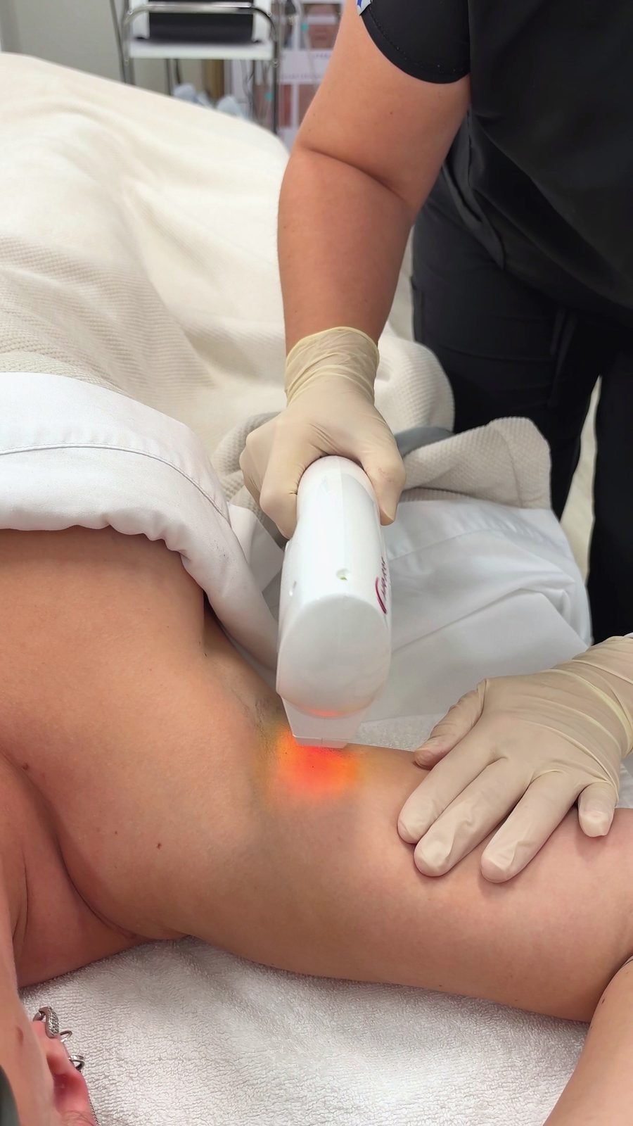 Laser hair removal at ERA Massage & Beauty